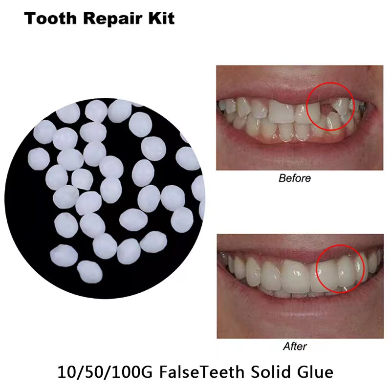 Teeth Whitening Mask - 10 g/borsa Kit di riparazione dei
