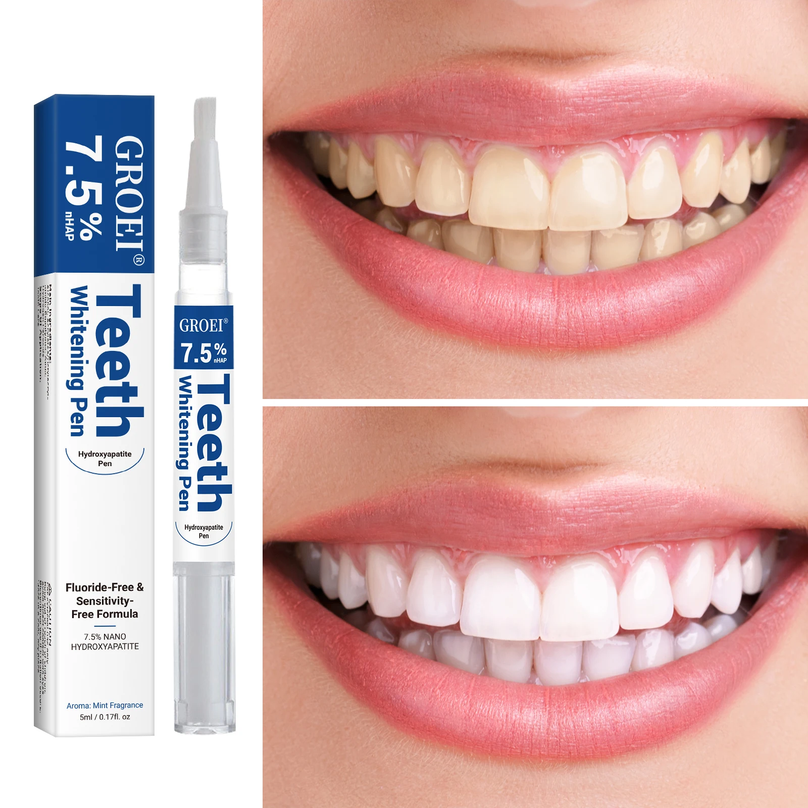 Penna per sbiancamento dei den - Teeth Whitening Near Me recensione e prezzo
