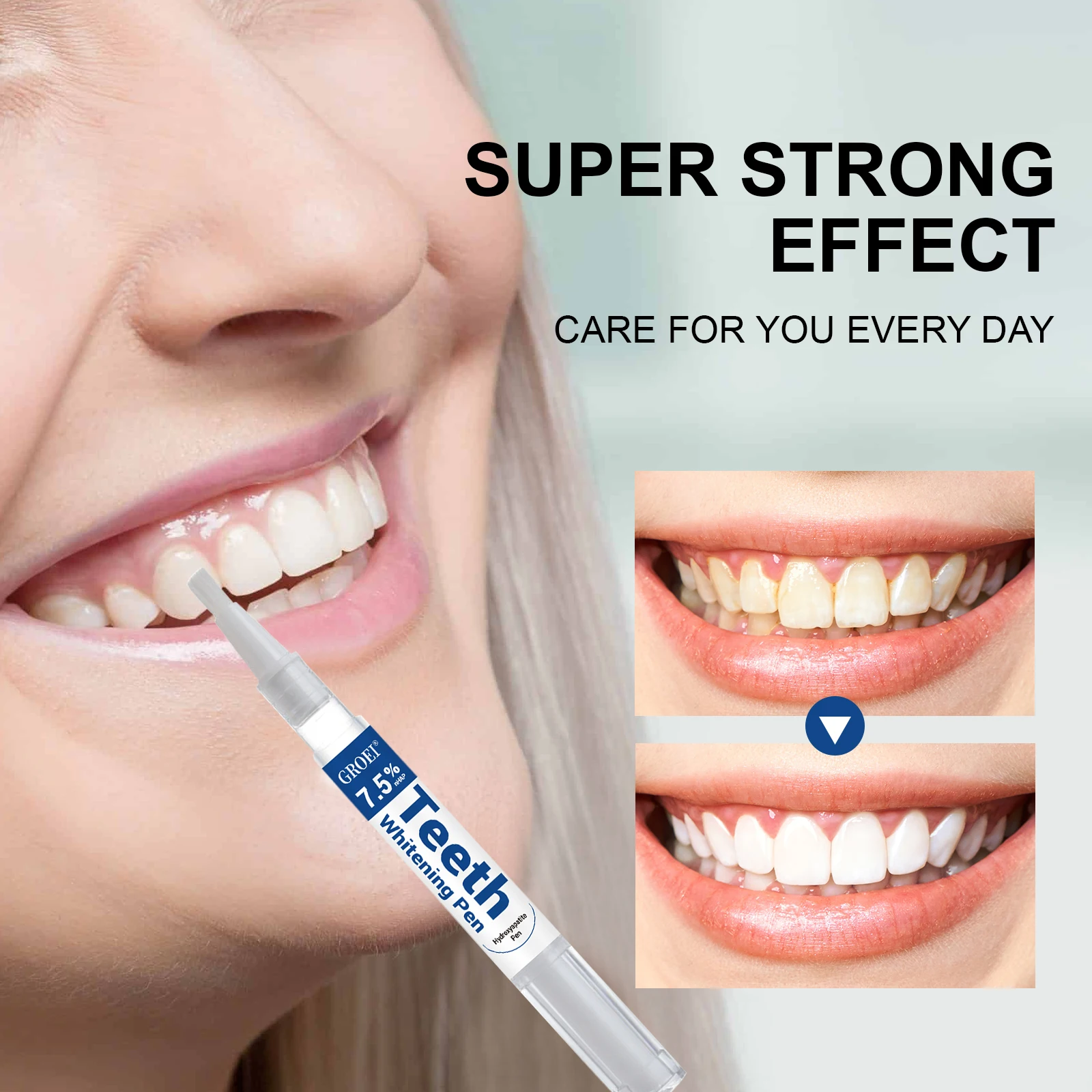 Penna per sbiancamento dei den - Teeth Whitening Near Me recensione e prezzo