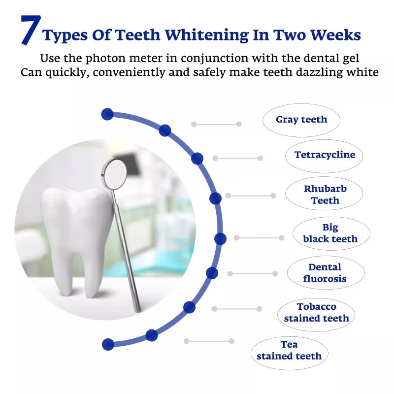 Dispositivo Intelligente di Sb - Teeth Whitening Device recensione e prezzo