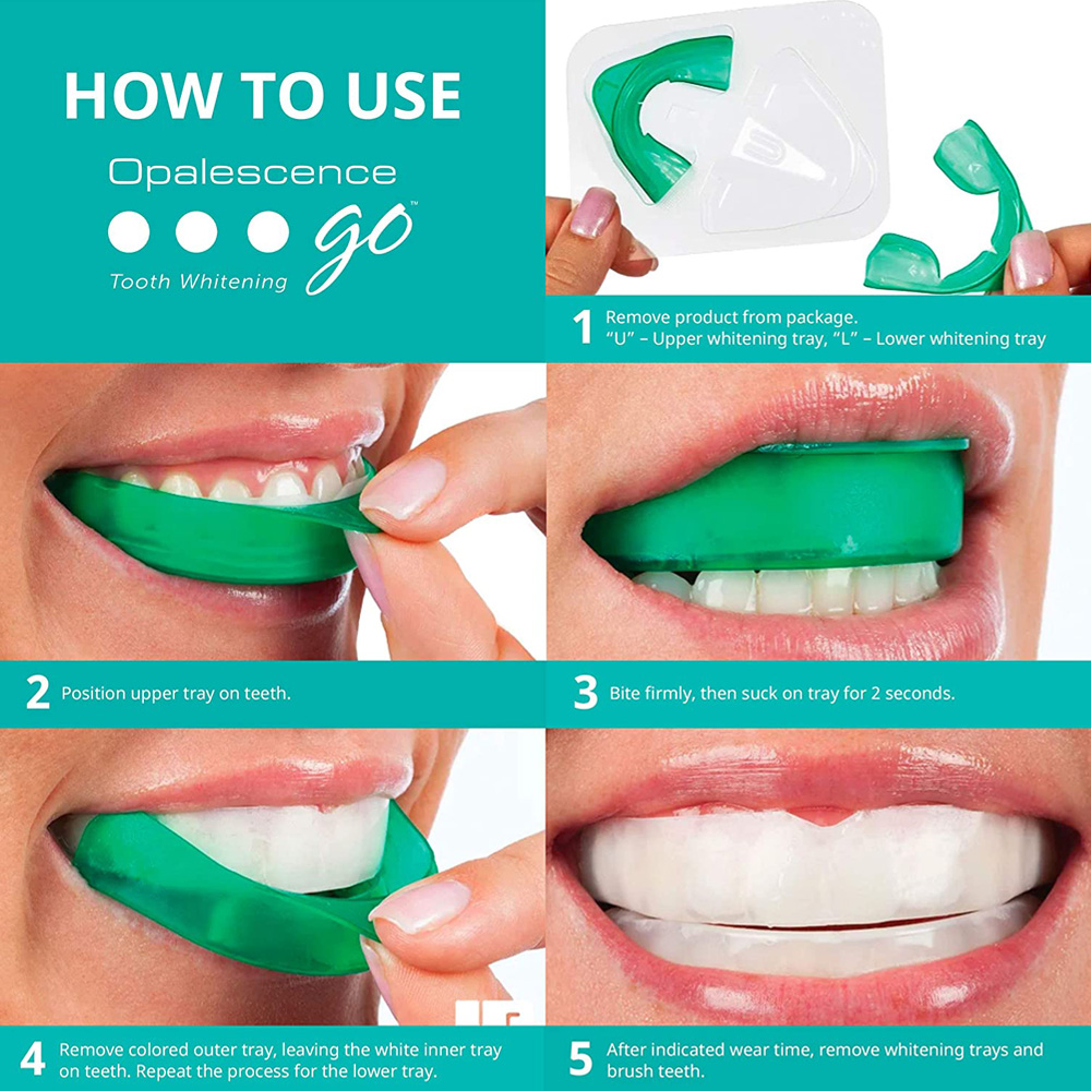 Perossido di idrogeno per sbia - Teeth Whitening Mask recensione e prezzo