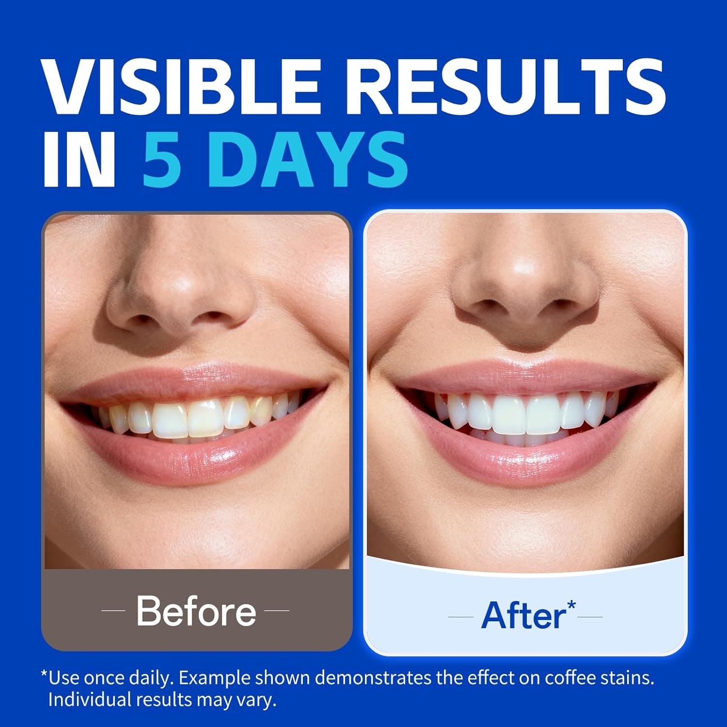 7 paia di strisce sbiancanti p - Teeth Whitening Strips Crest recensione e prezzo