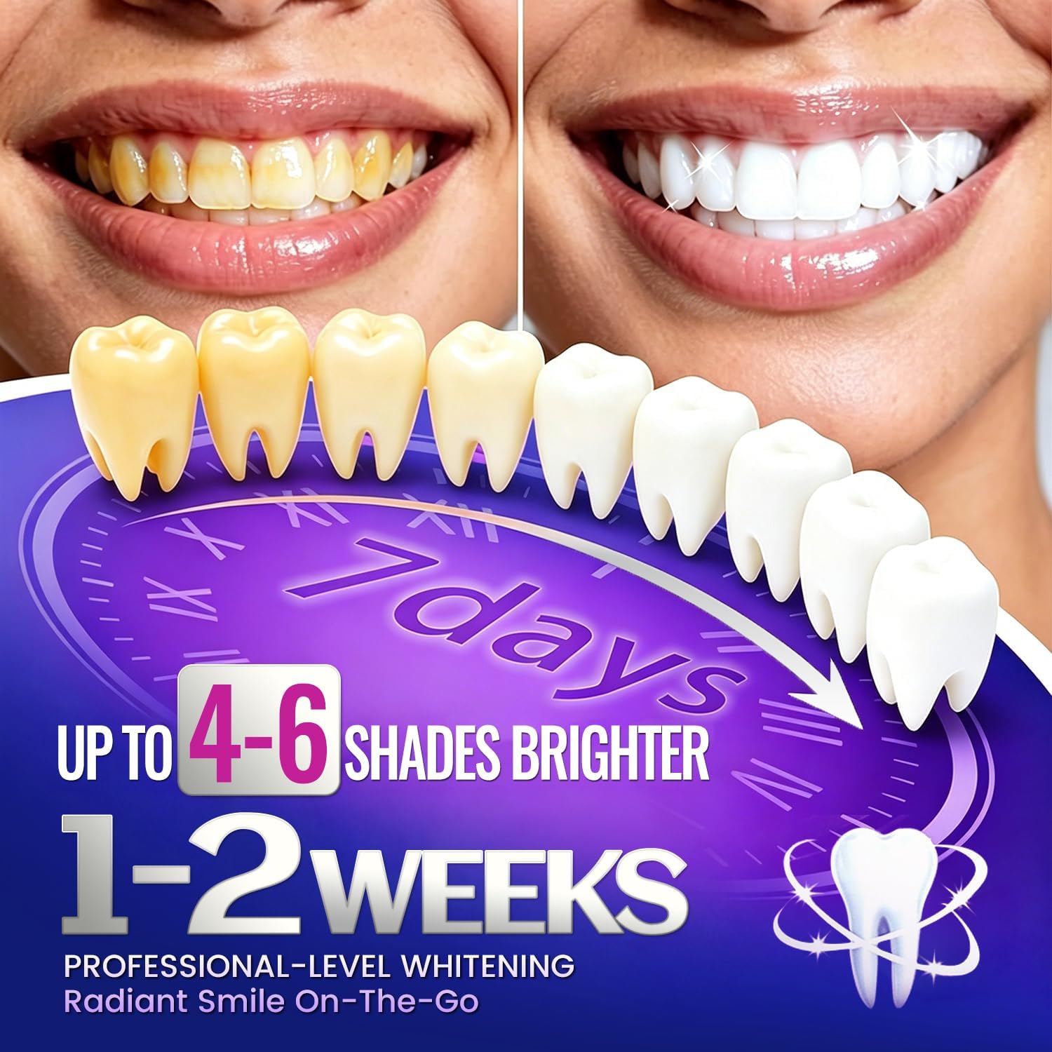 7 paia di strisce sbiancanti p - Teeth Whitening Strips Crest recensione e prezzo
