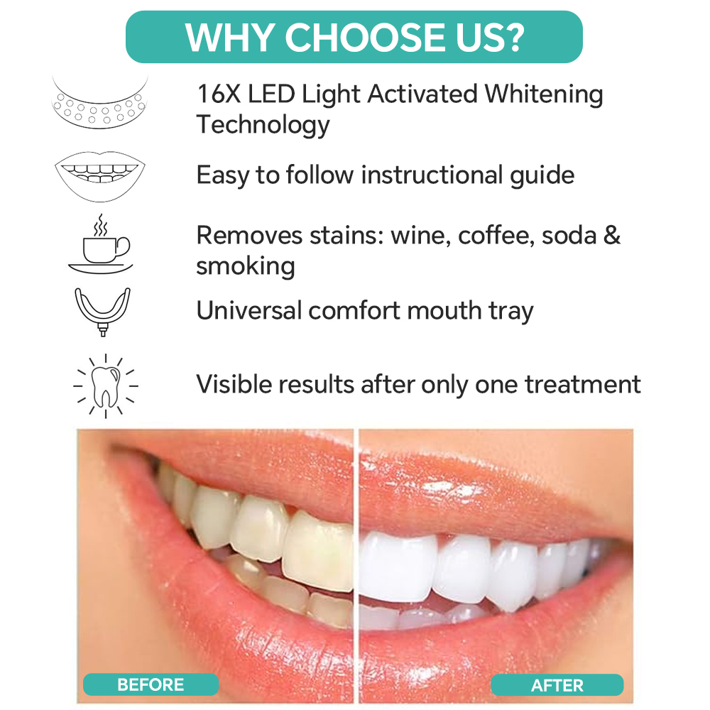 Lampada Sbiancante per Denti,  - Led Mouth Tray recensione e prezzo