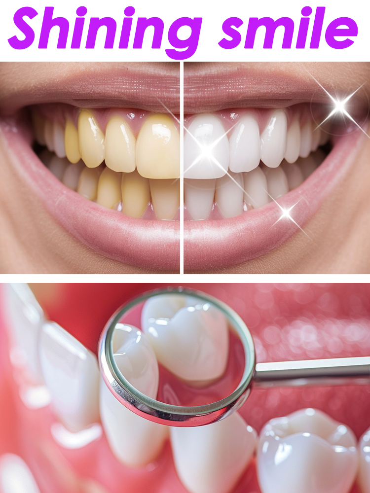 GlorySmile Sbiancamento dei de - Teeth Whitening Xylitol recensione e prezzo