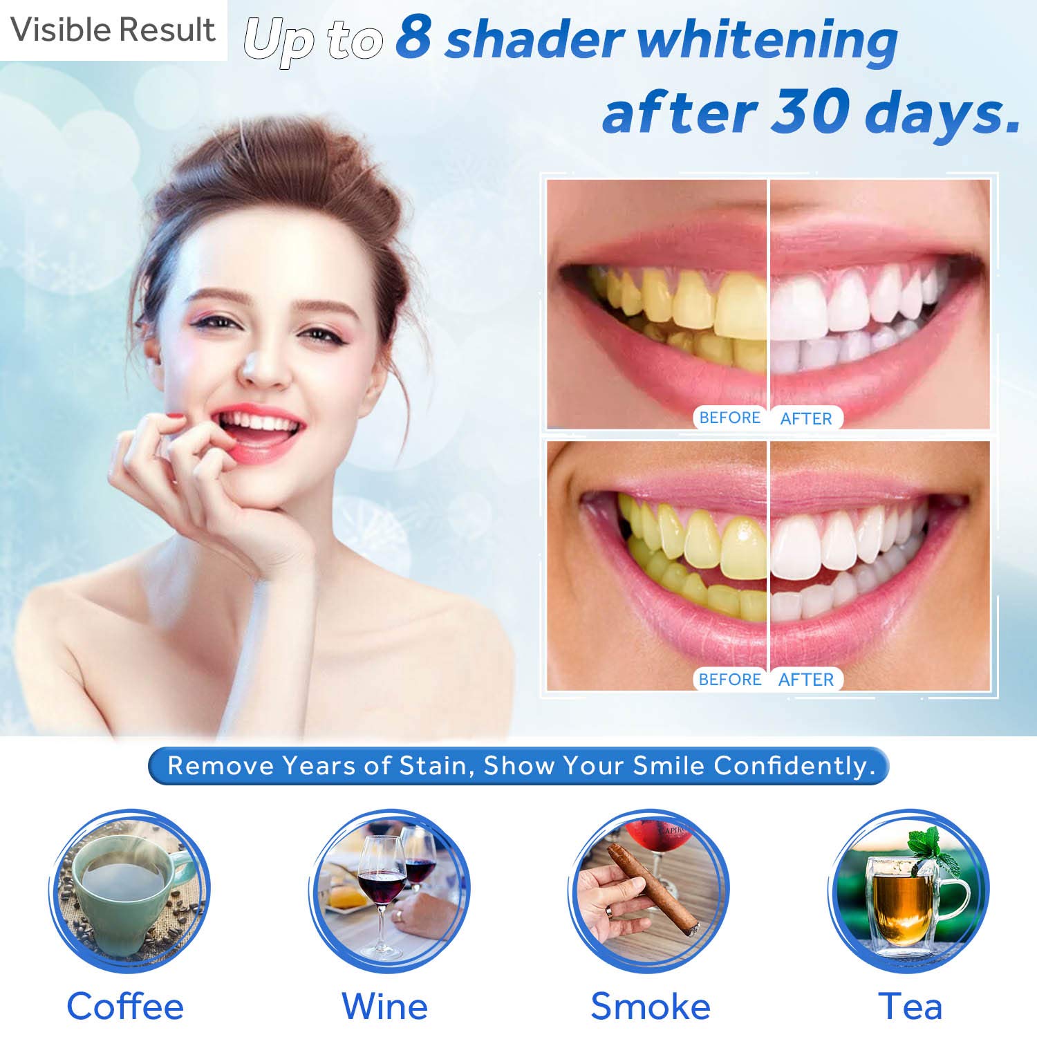 Gel sbiancante per denti Ricar - Teeth Whitening Near Me recensione e prezzo