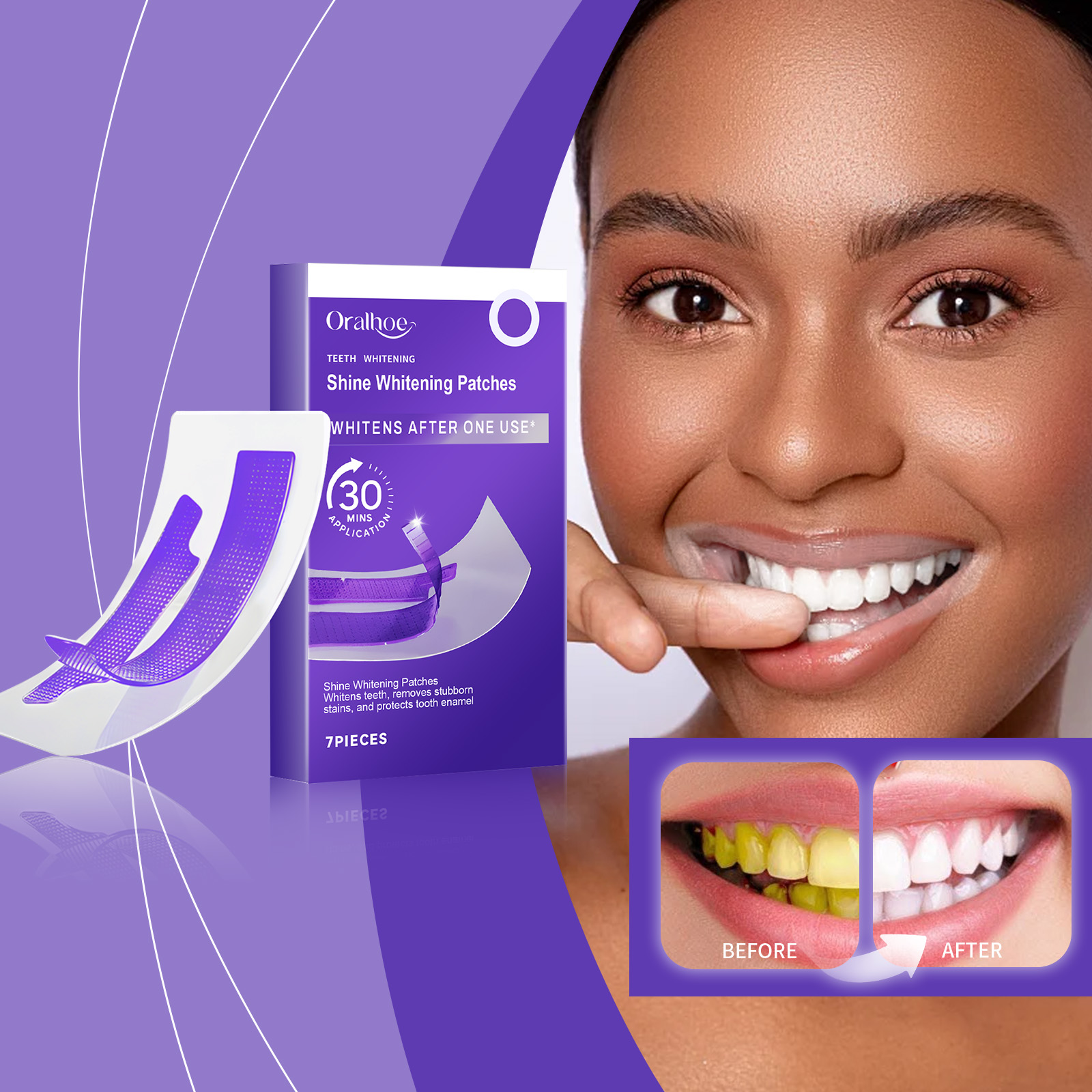 Strisce sbiancanti per denti v - Teeth Whitening Strips Crest recensione e prezzo