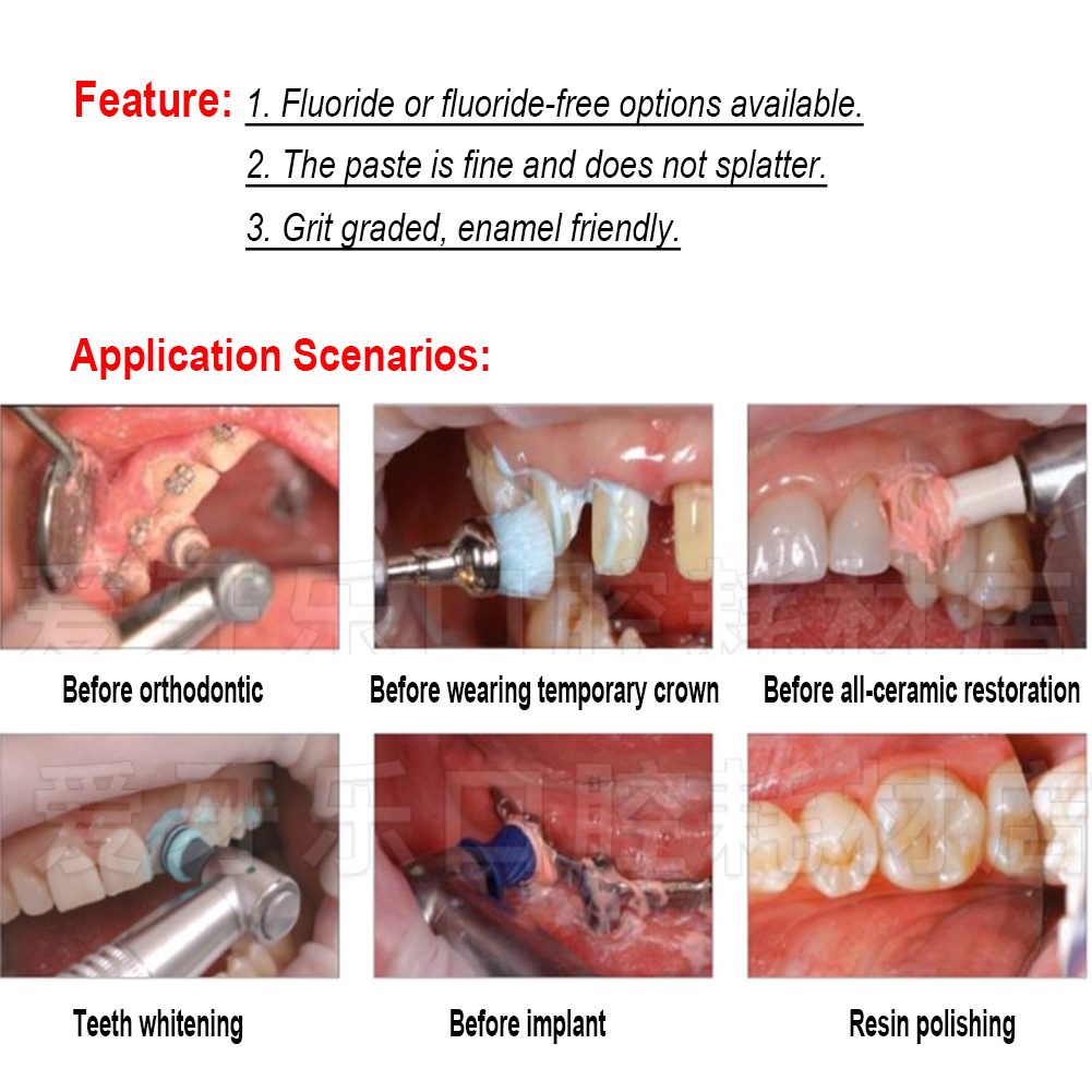 Pasta Lucidante per Denti Ivoc - Teeth Whitening Xylitol recensione e prezzo