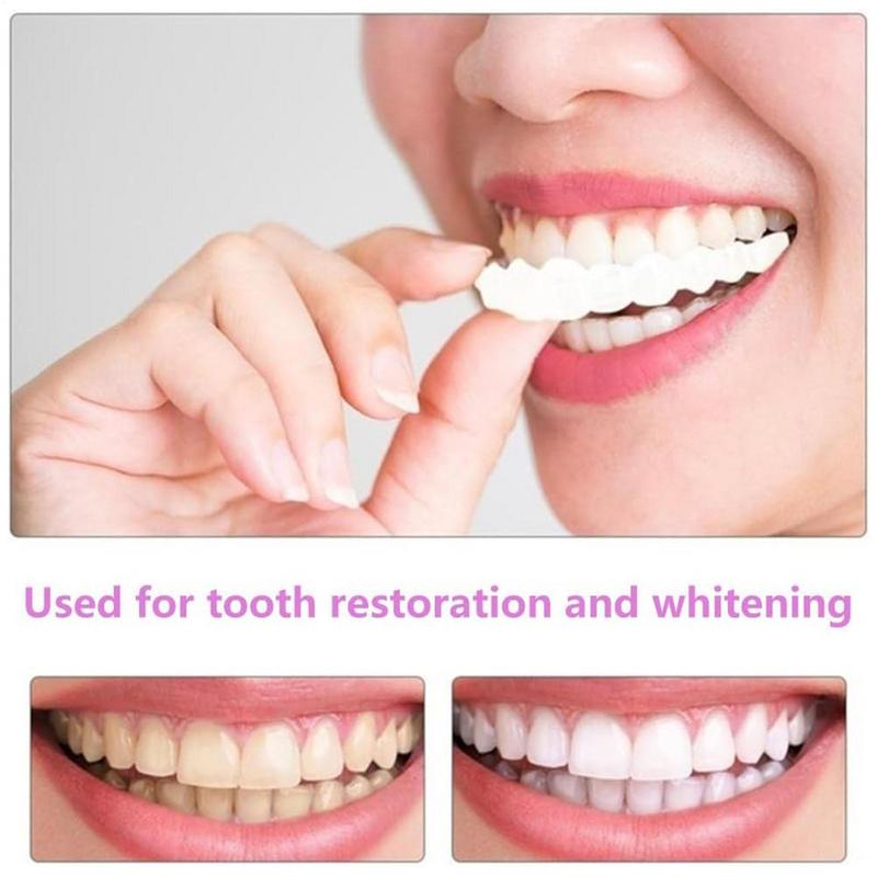 Impiallacciature per denti a s - Teeth Whitening Mask recensione e prezzo