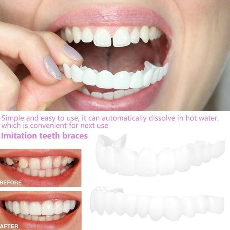 Impiallacciature per denti a s - Teeth Whitening Mask recensione e prezzo