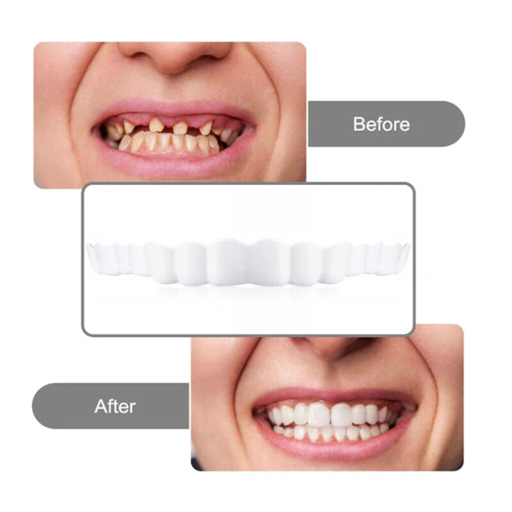4-6 paia di protesi per mascel - Teeth Whitening Mask recensione e prezzo