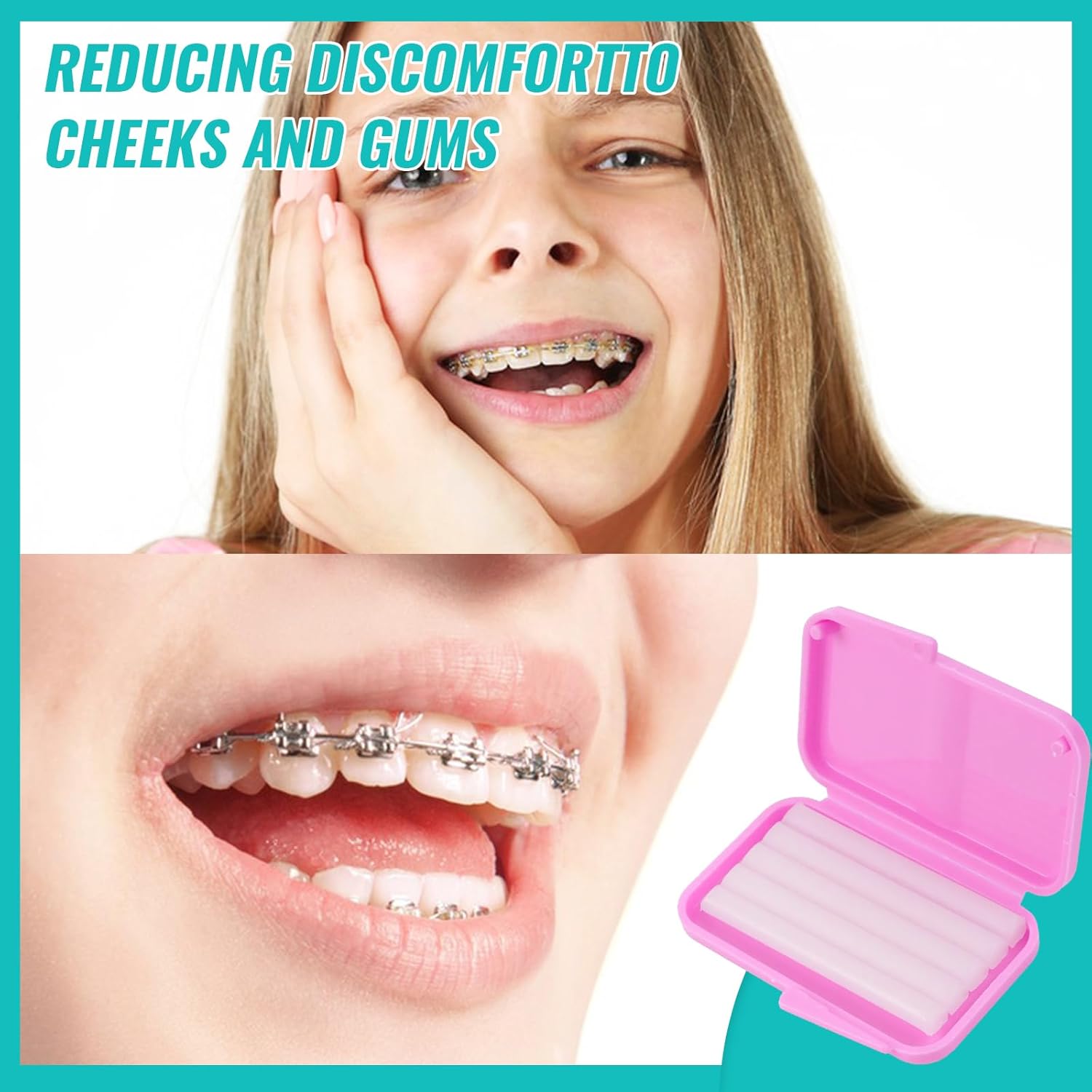 10 scatole Dentale Ortodontico - Teeth Whitening Gum recensione e prezzo