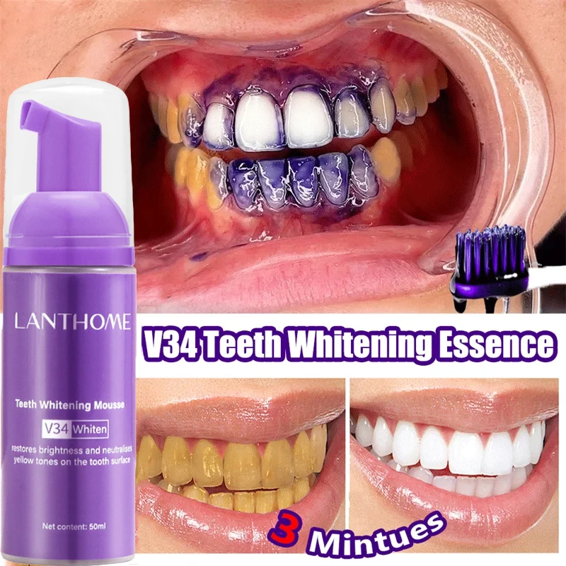 V34 Mousse sbiancante per dent - Teeth Whitening Xylitol recensione e prezzo