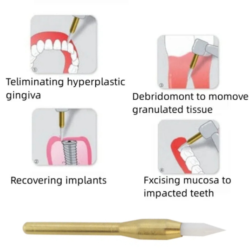 Dentale Morbido Trimmer Frese  - Teeth Whitening Gum recensione e prezzo