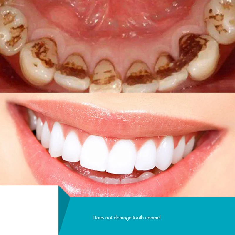 Polvere di denti a base di erb - Teeth Whitening Xylitol recensione e prezzo