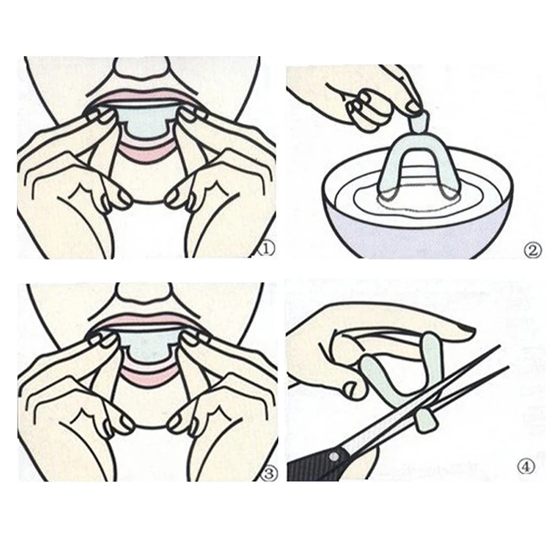 Set di 10 Protezioni per Denti - Teeth Whitening For Trays recensione e prezzo